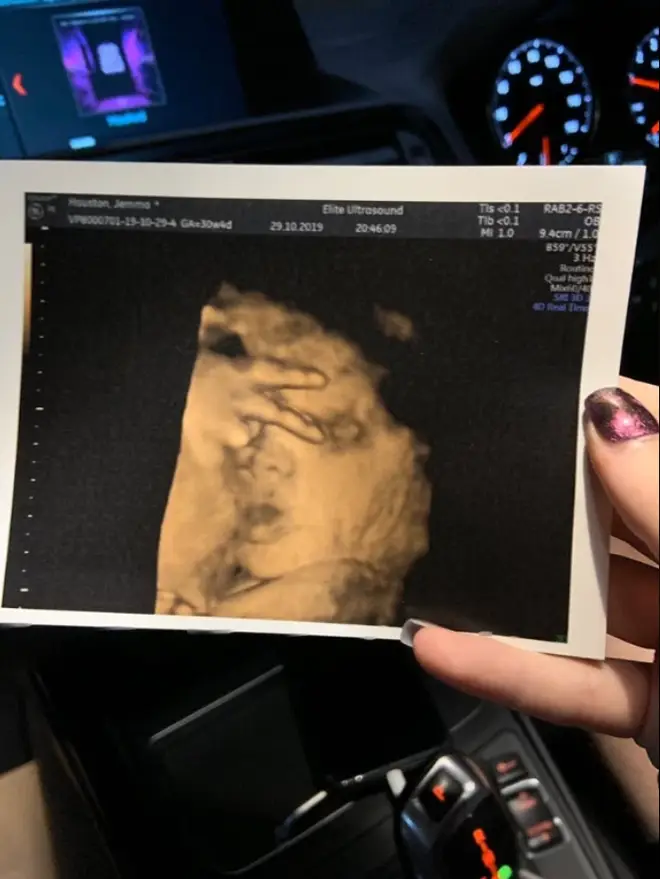 Jemma paid for a 4D ultrasound of her unborn daughter